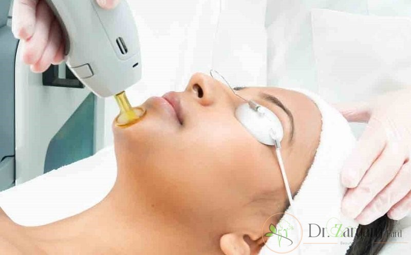چه خدماتی در مراکز لیزر انجام می شود؟