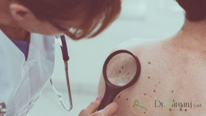 چرا داشتن یک دکتر پوست مهم است؟