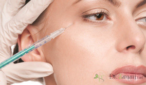 تزریق ژل زیر چشم با کائولا