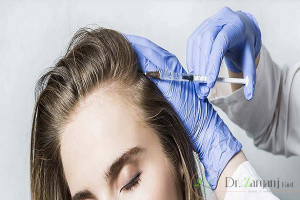 نتیجه عمل کربوکسی تراپی مو چگونه است؟