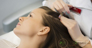 آیا قبل از انجام کربوکسی تراپی مو نیاز به آمادگی می باشد؟