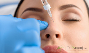 قبل از انجام هر اقدامی برای برجسته سازی به وسیله تزریق ژل دانستن چه مواردی لازم است؟