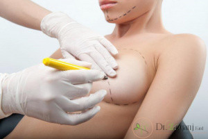 جراحی زیبایی برای بزرگ کردن سینه