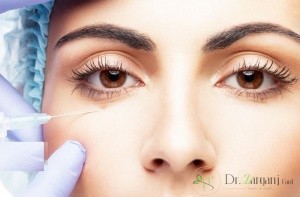 میزان ماندگاری استفاده از روش کربوکسی تراپی تا چه اندازه است: