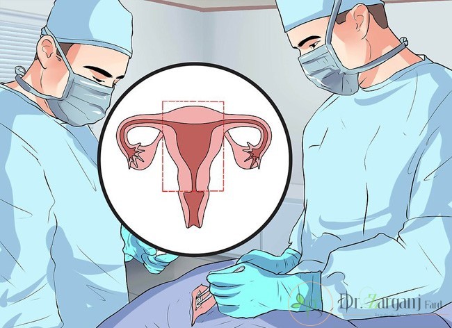 درمان واژینیسموس با کمک جراحی بزرگ کردن واژن