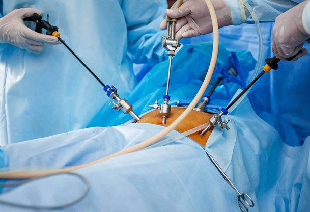 در چه مواردی نیاز به عمل جراحی تنبلی تخمدان می باشد؟